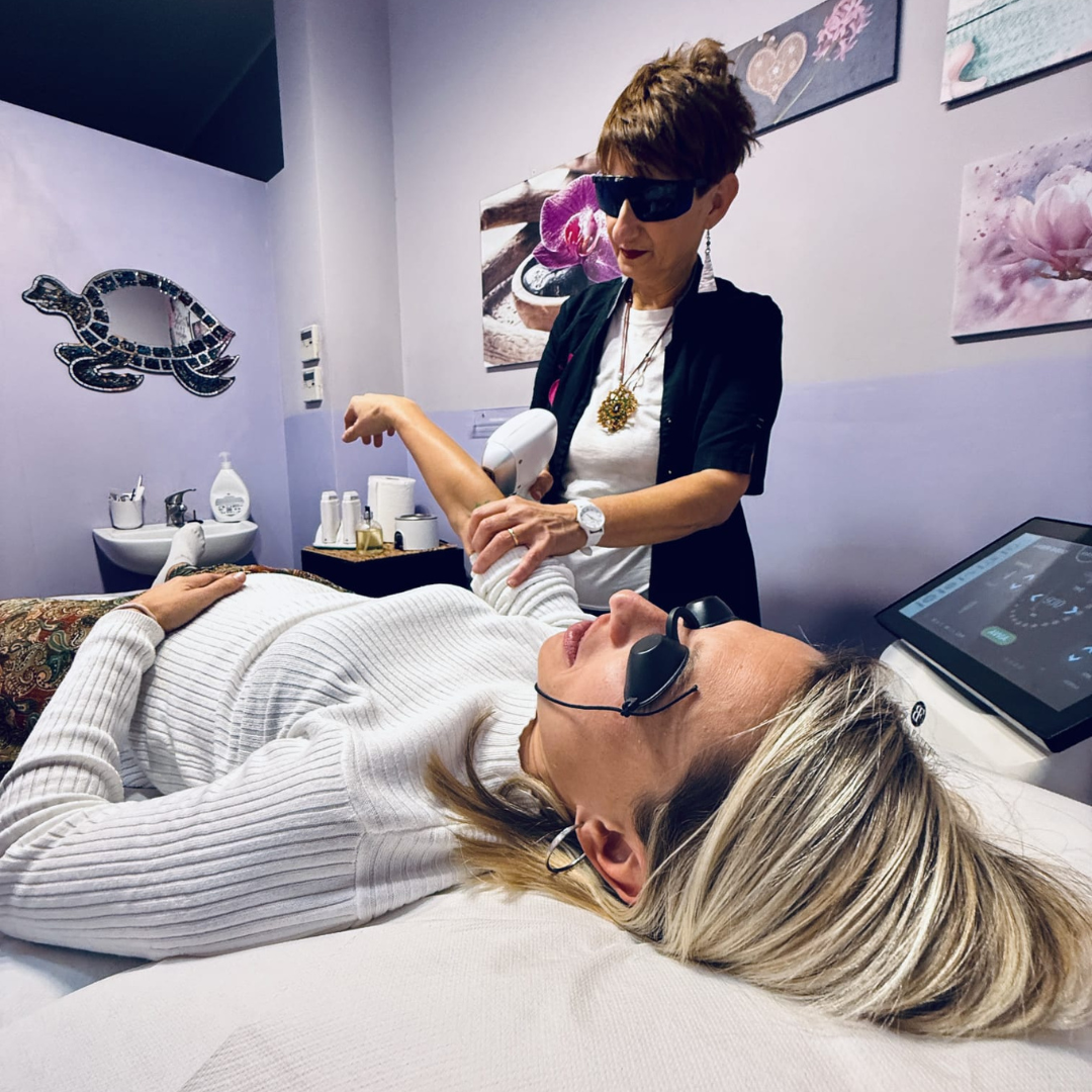 Epilazione laser definitiva